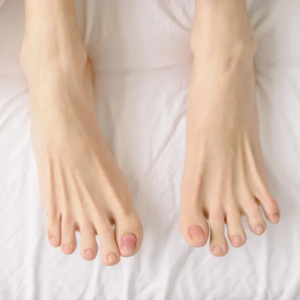 Bare feet with clean, natural toenails on white bed sheets